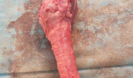 解剖视频,视频解析与知识概览